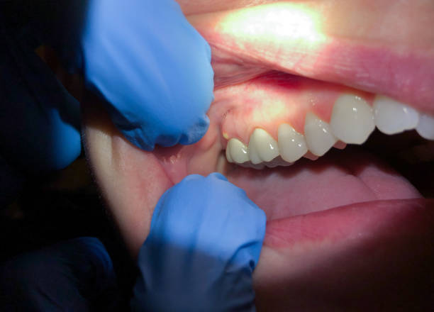 Best Emergency Cosmetic Dentistry (e.g., broken veneers) in USA